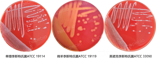 羊血瓊脂基礎培養基的微生物質控結果