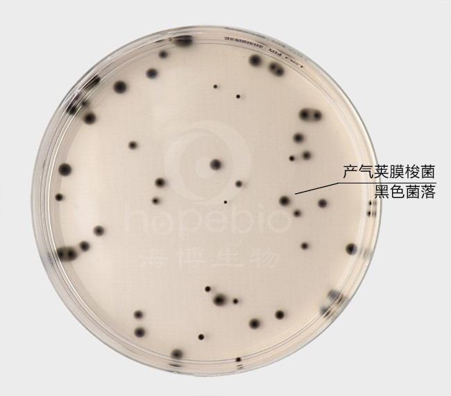 強化梭菌鑒別瓊脂(DRCA)微生物質控結果