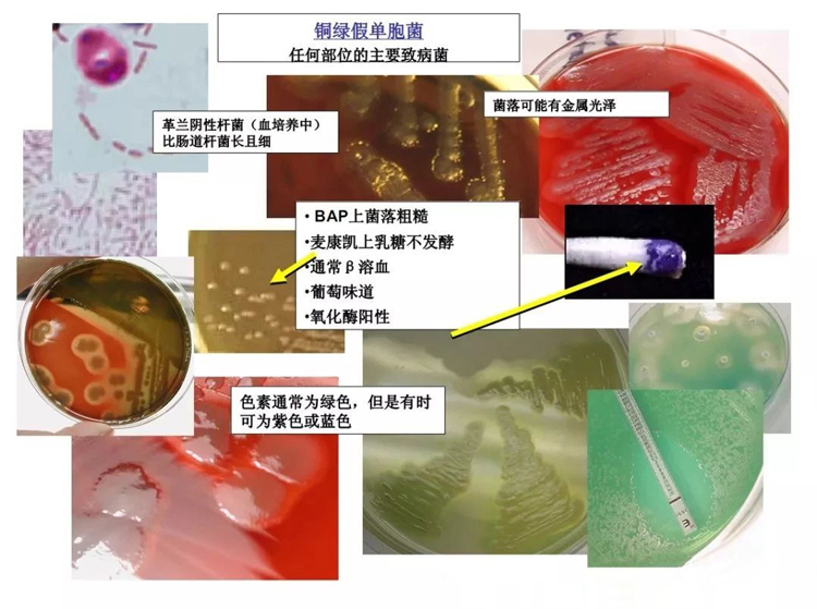 銅綠假單胞菌生化特征