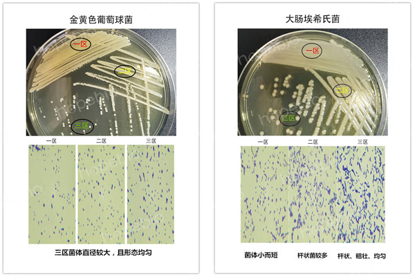 細菌在平板三區的形態特征對比