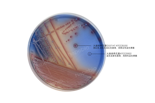 O157顯色培養基——大腸埃希氏菌O157-大腸埃希氏菌