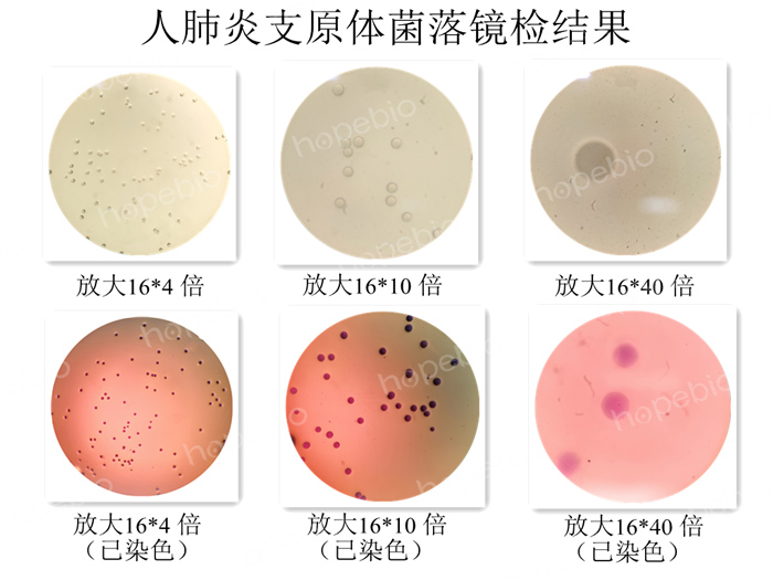 人肺炎支原體菌落鏡檢結果