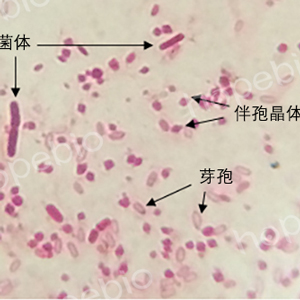 0.5%堿性複紅溶液-生化-鏡檢-芽孢杆菌/