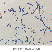 革蘭氏染色鏡檢圖——蠟樣芽孢杆菌/